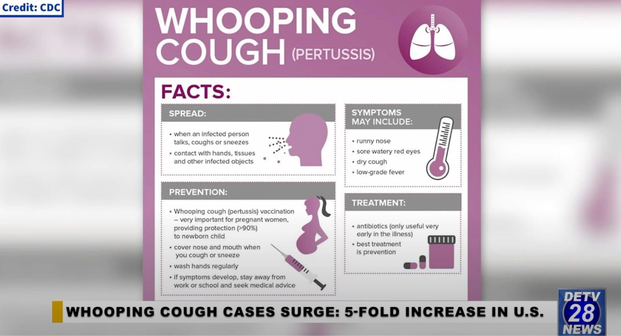 surge in whooping cough cases